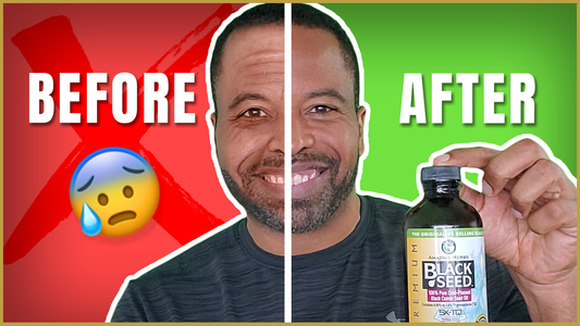 Harness the Benefits of Black Seed Oil for Optimal Health
